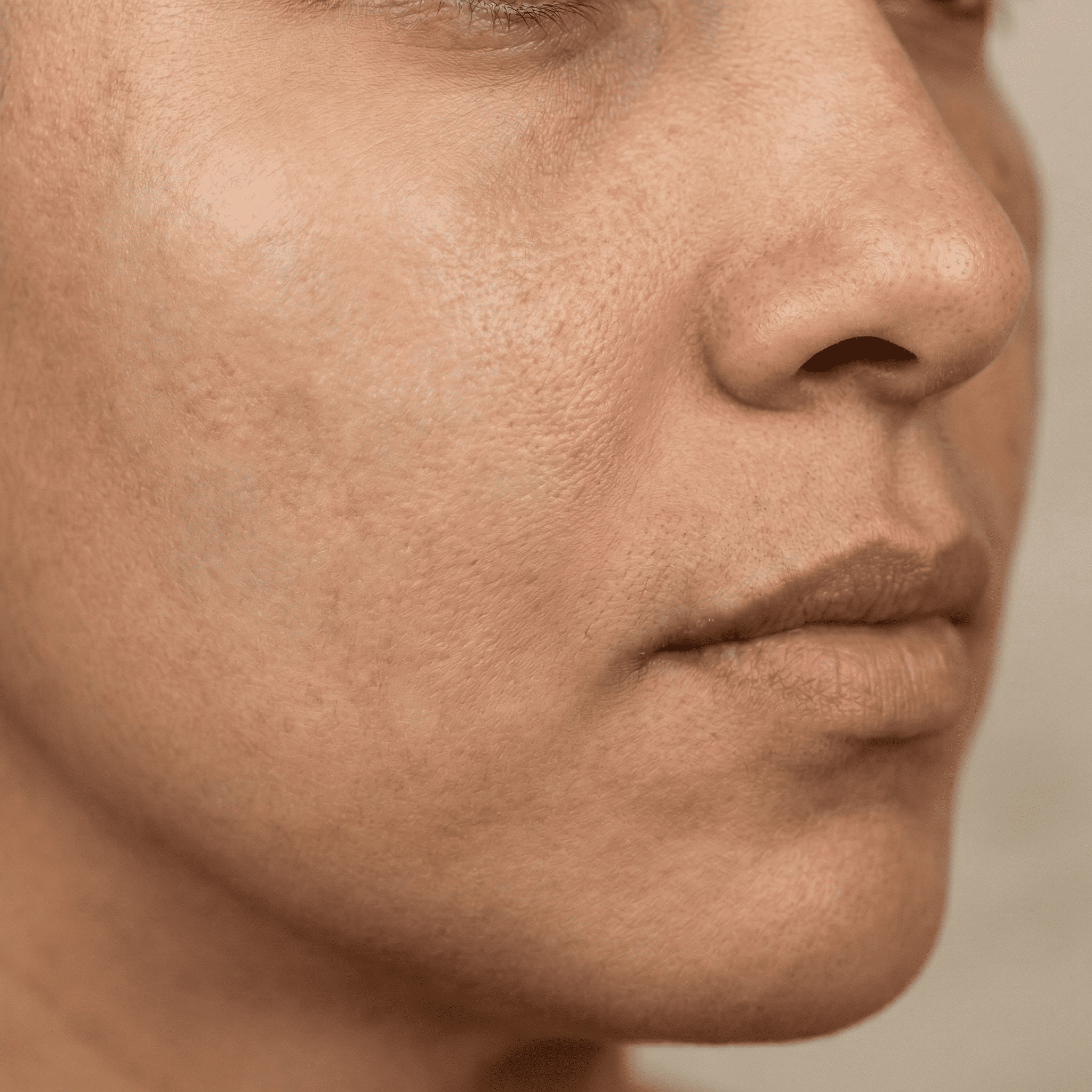 Depois do tratamento