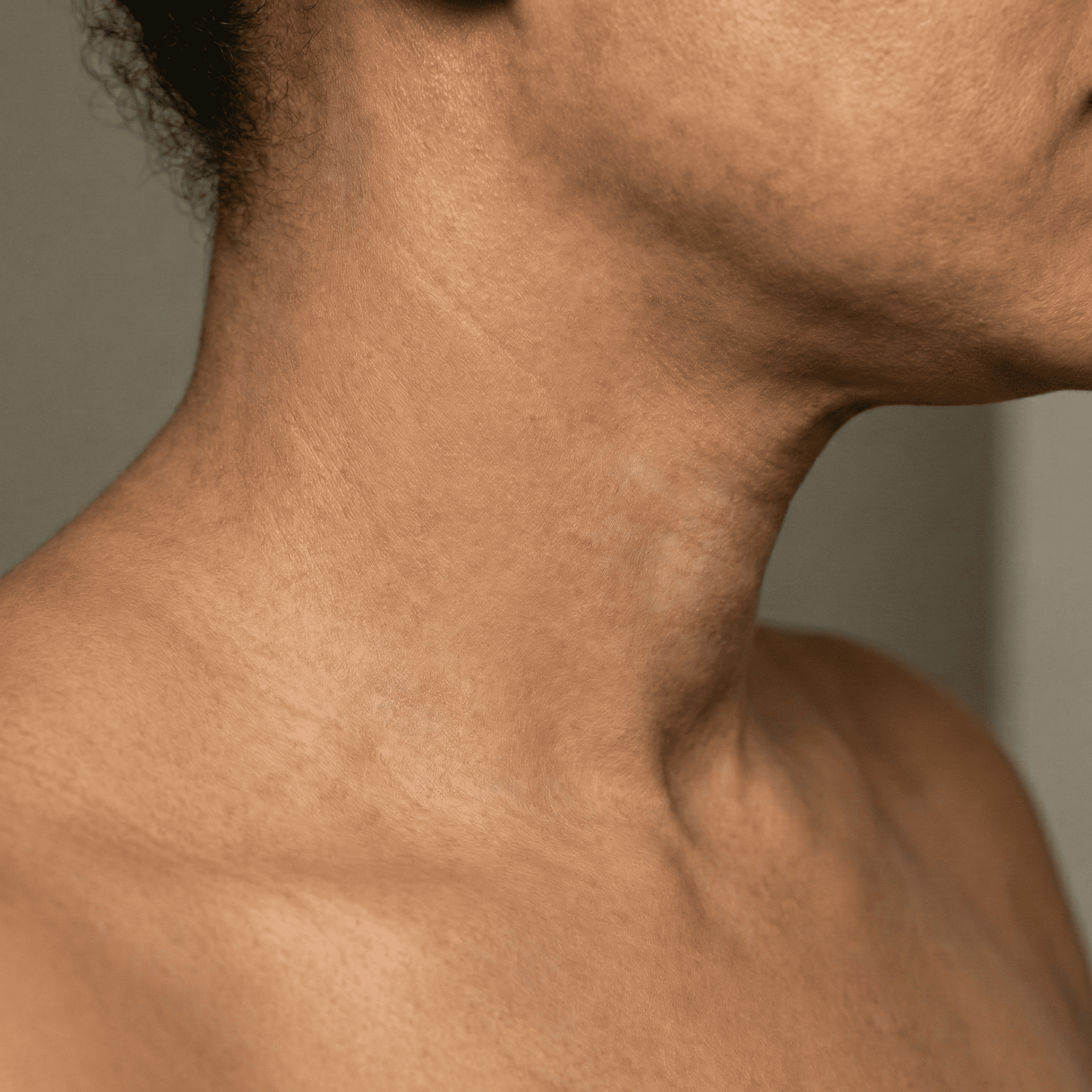 Depois do tratamento